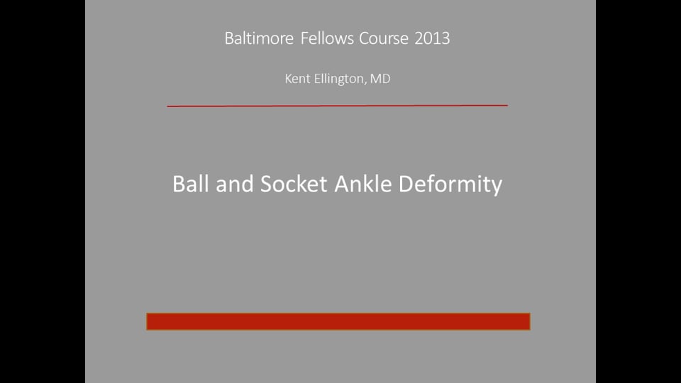 Baltimore Fellows Course 2013: Ball and Socket Ankle Deformity - Kent Ellington, MD