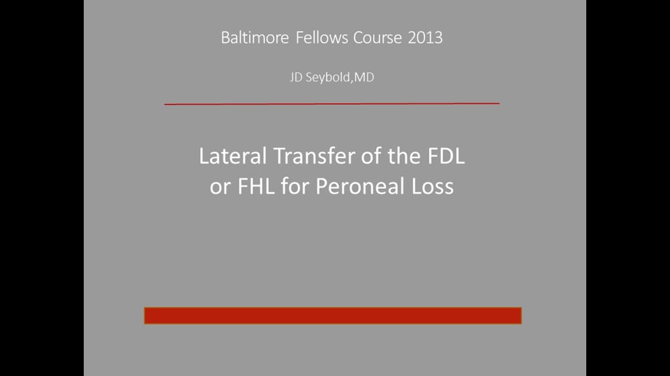Baltimore Fellows Course 2013: Lateral Transfer of the FDL or FHL for Peroneal Loss-JD Seybold,MD