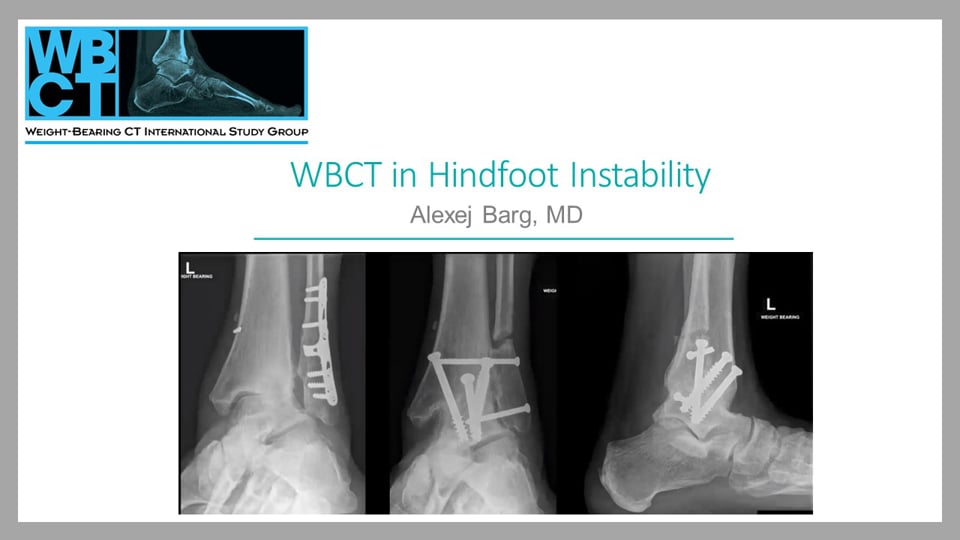 WBCT ISG Webcast: Weight Bearing CT in Hindfoot Instability