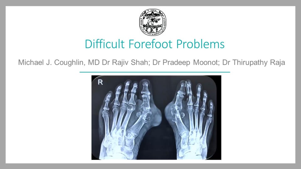 IFAS Webcast: Difficult Forefoot Problems