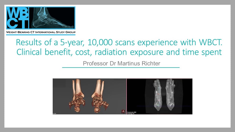 WBCT ISG Webcast: Results of a 5 year, 10,000 scans experience with WBCT. Clinical benefit, cost, radiation exposure and time spent